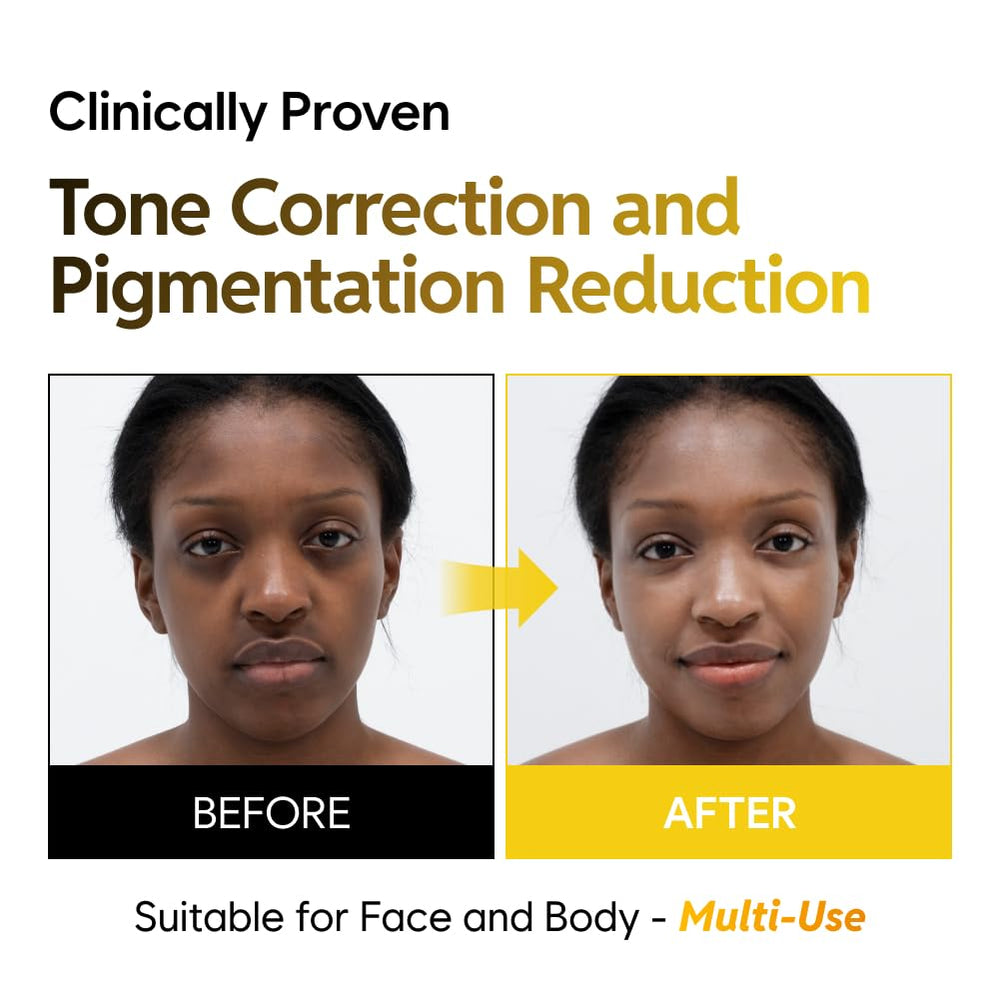 SAEKDONG SEOUL kojic turmeric ingredients detail promotes skin brightening potential.