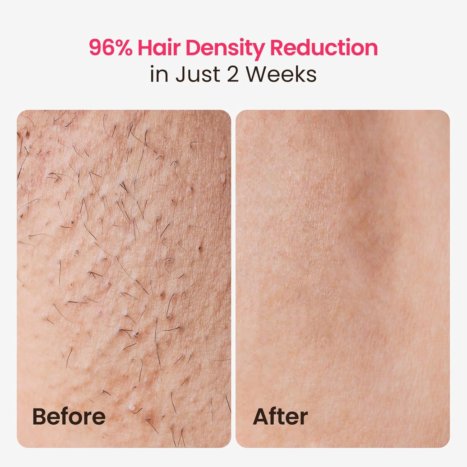 SALLOOT full-body auto-glide mode delivers fast at-home treatments