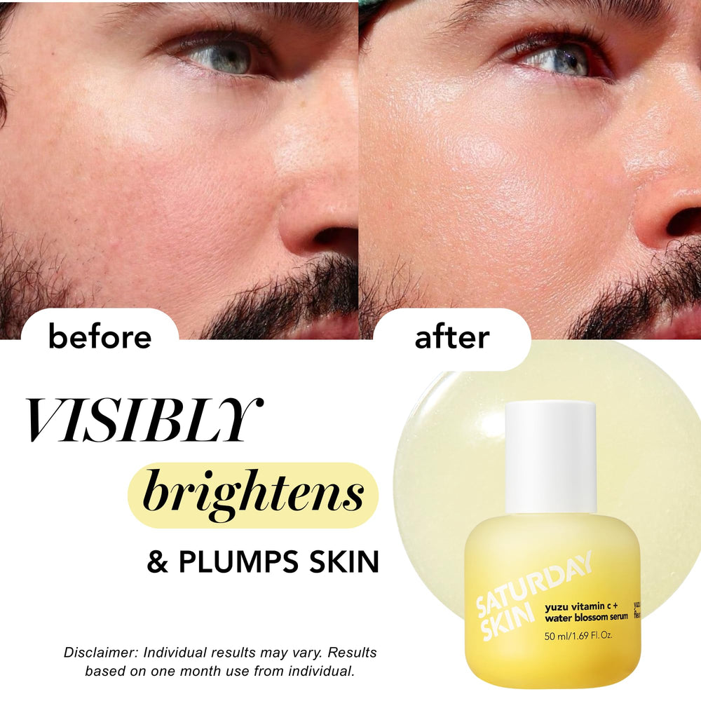 Saturday Skin ceramides-barrier-boost closeup indicating stronger barrier & comfort