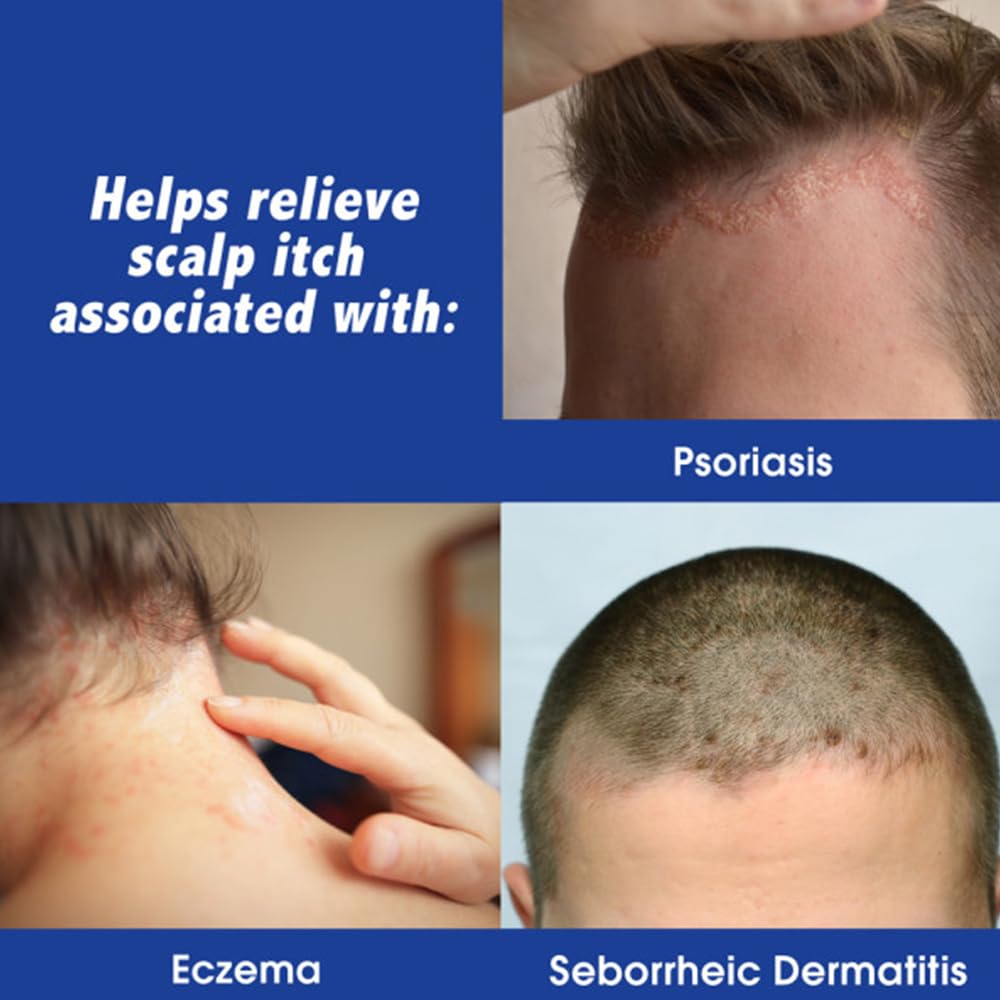 Scalpicin application tip view demonstrates easy-to-use scalp treatment.