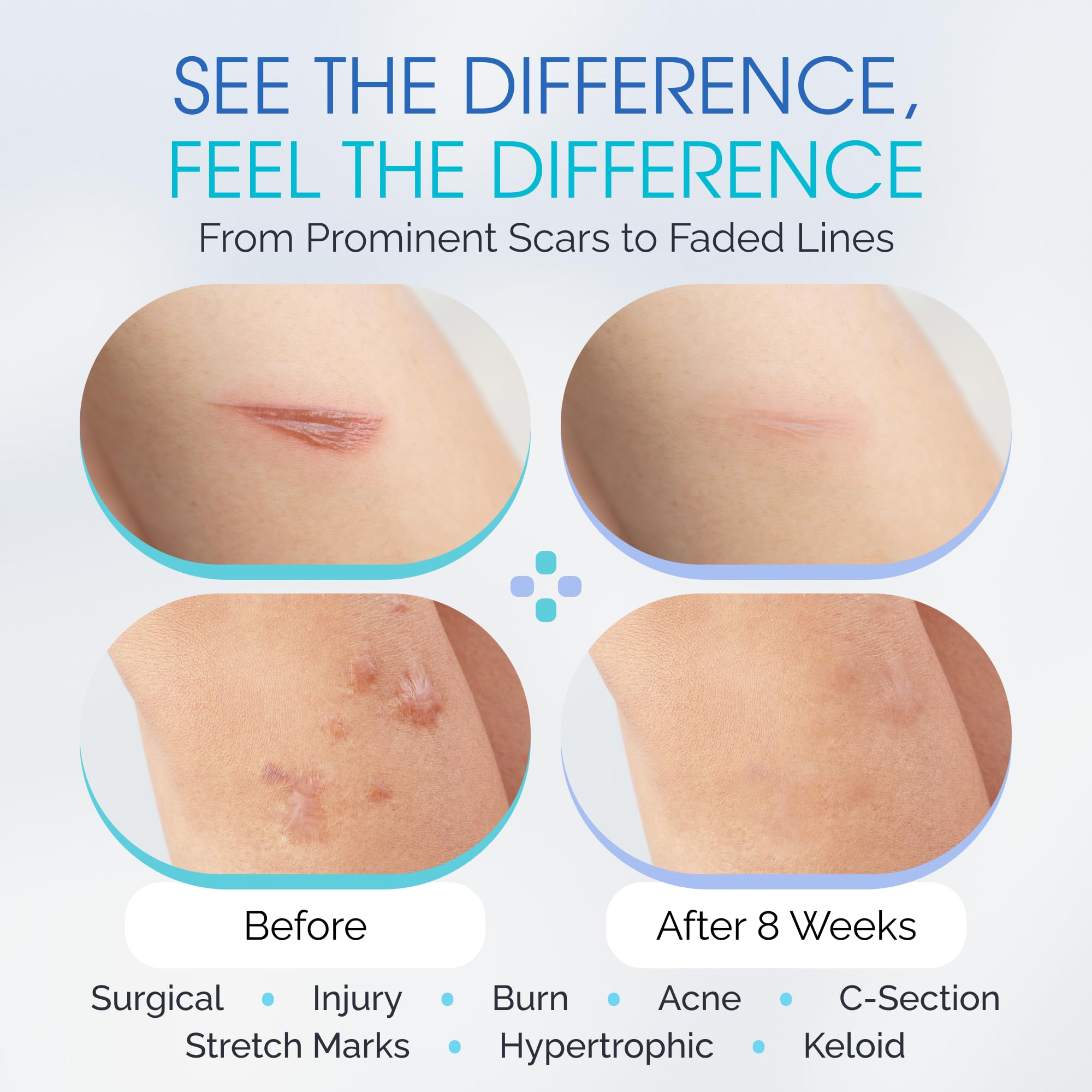 ScarScience soothing gel reducing itching sensations on healing skin.