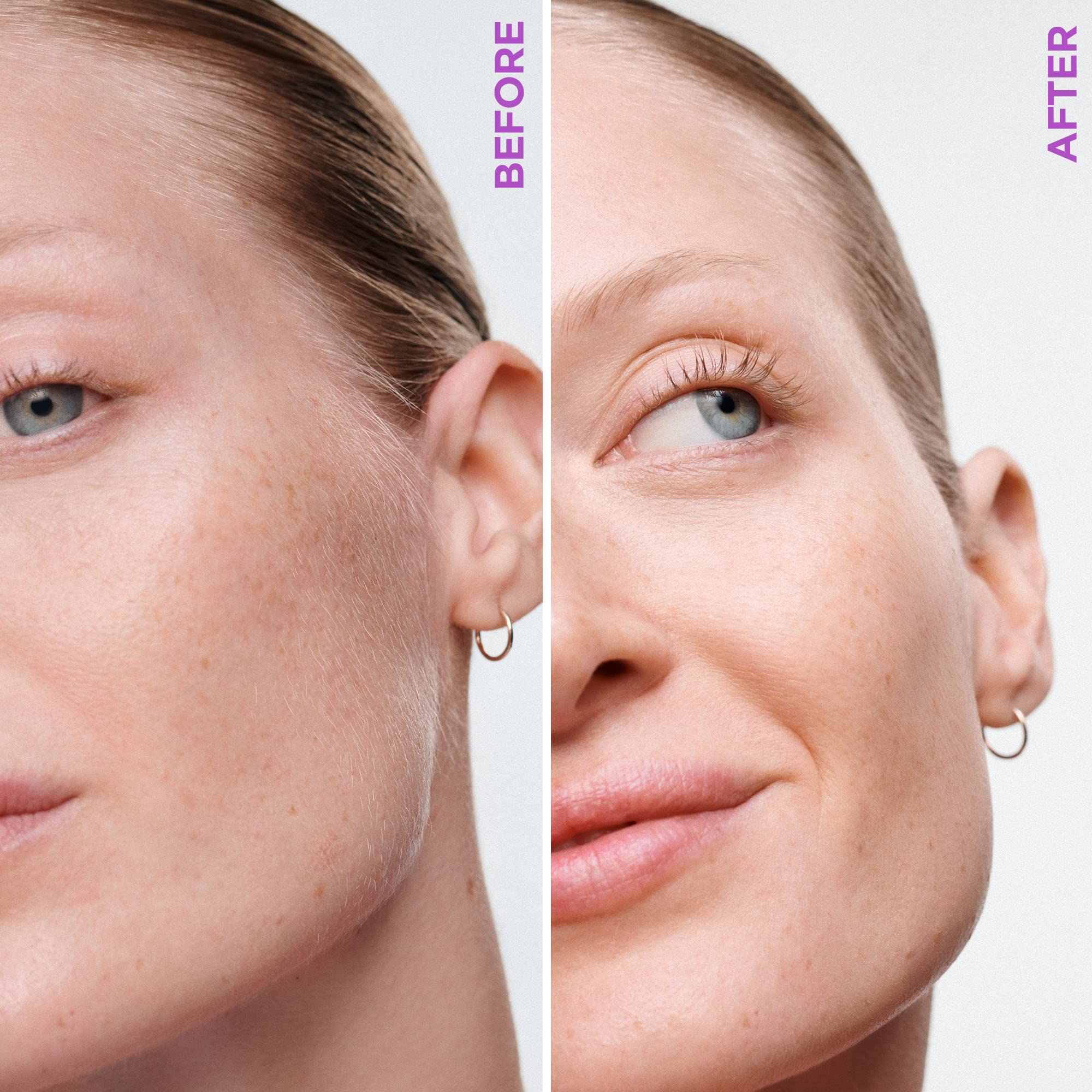 Schick Hydro Silk user applying refill blade — precision exfoliation for radiant skin
