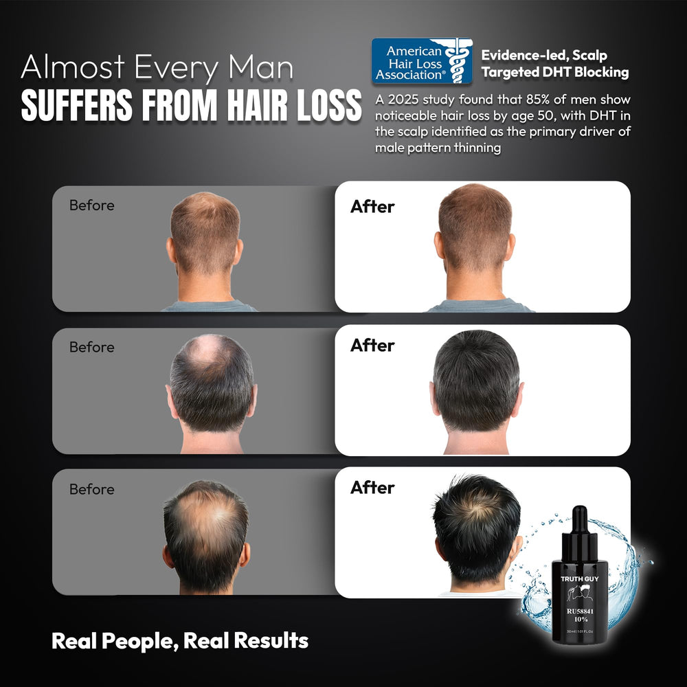 Truth Guy RU58841 application on scalp illustrating daily-use routine