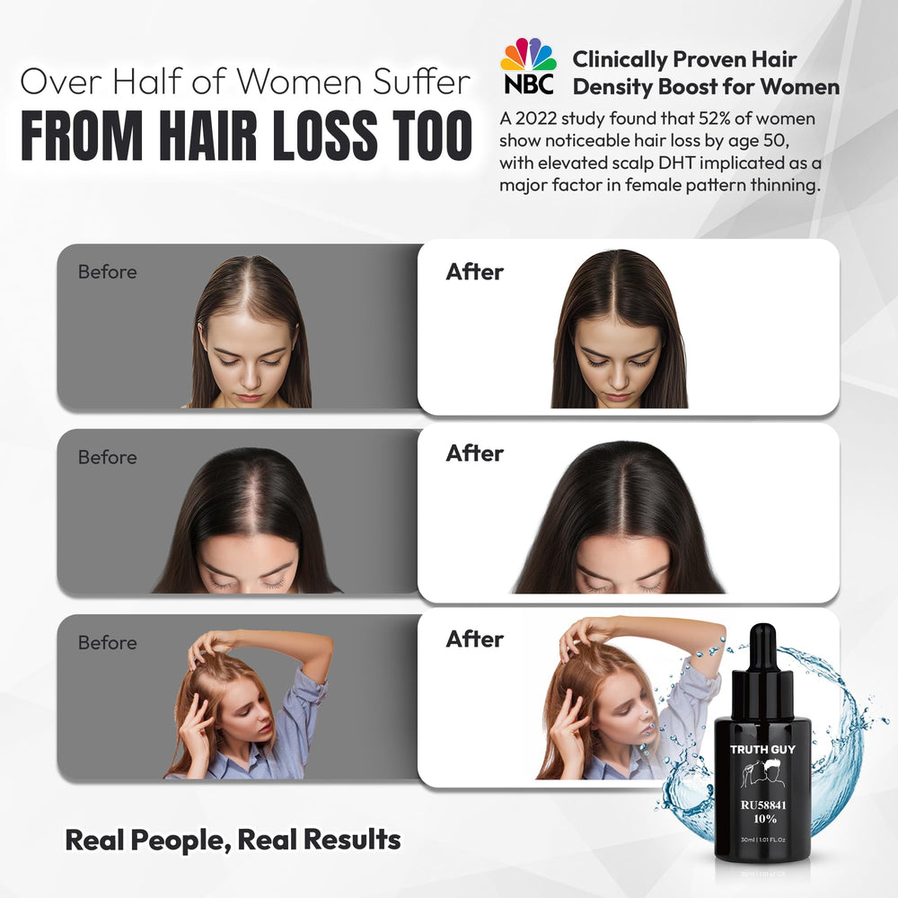 Science Backed Naturals Truth Guy RU58841 10% drops on fingertips for targeted thinning areas