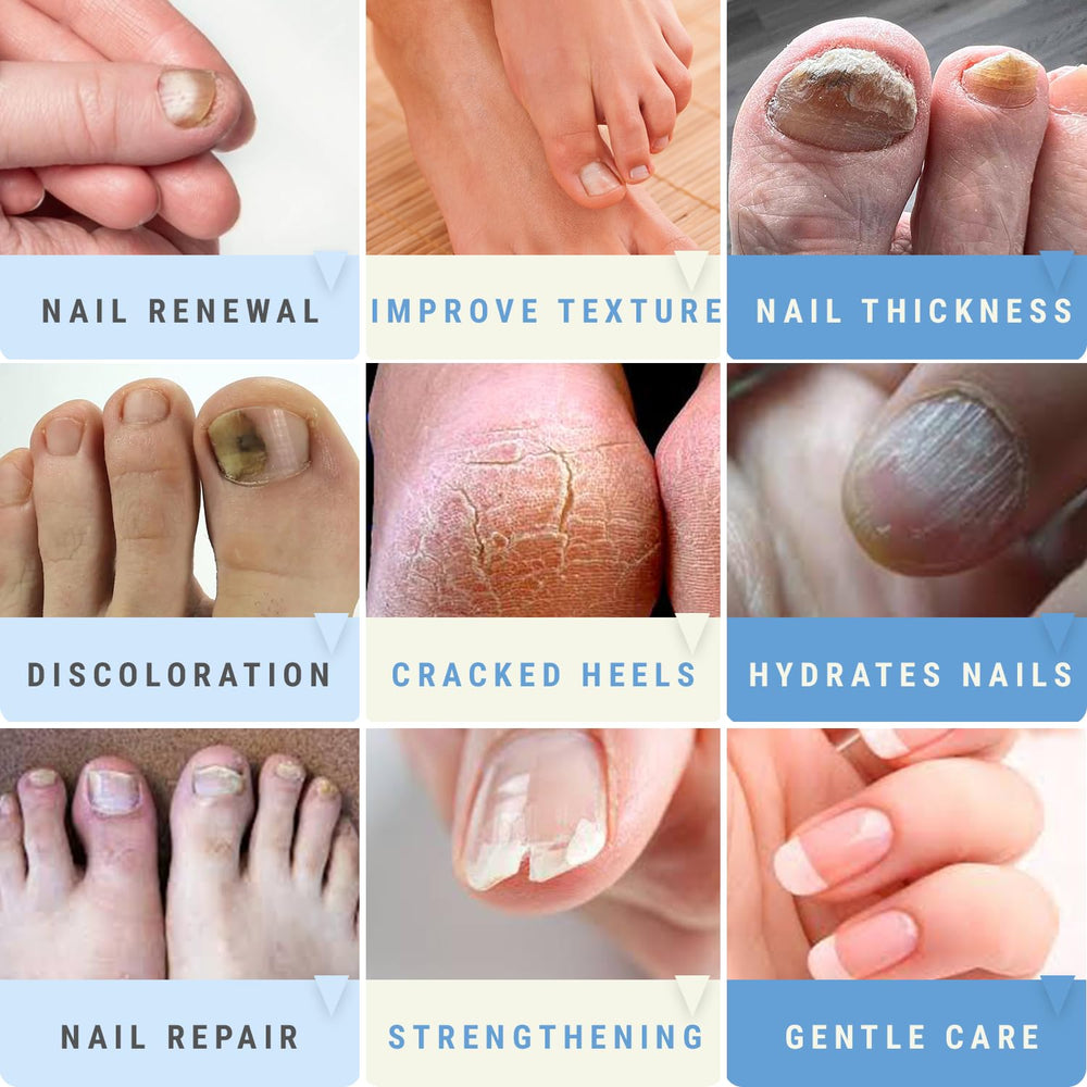 Scientific Solutions Global Urea 50 Nail Gel – thick nails care improves texture.