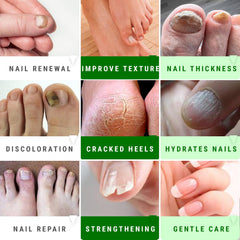 Scientific Solutions Global Urea Nail Gel treats thick nails for easier shaping