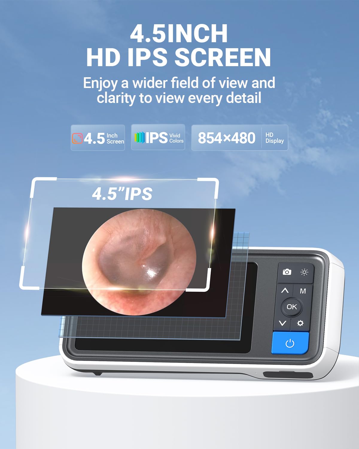 ScopeAround otoscope 4.5-inch IPS monitor offers high-resolution viewing without a phone