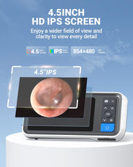 ScopeAround otoscope 4.5-inch IPS monitor offers high-resolution viewing without a phone