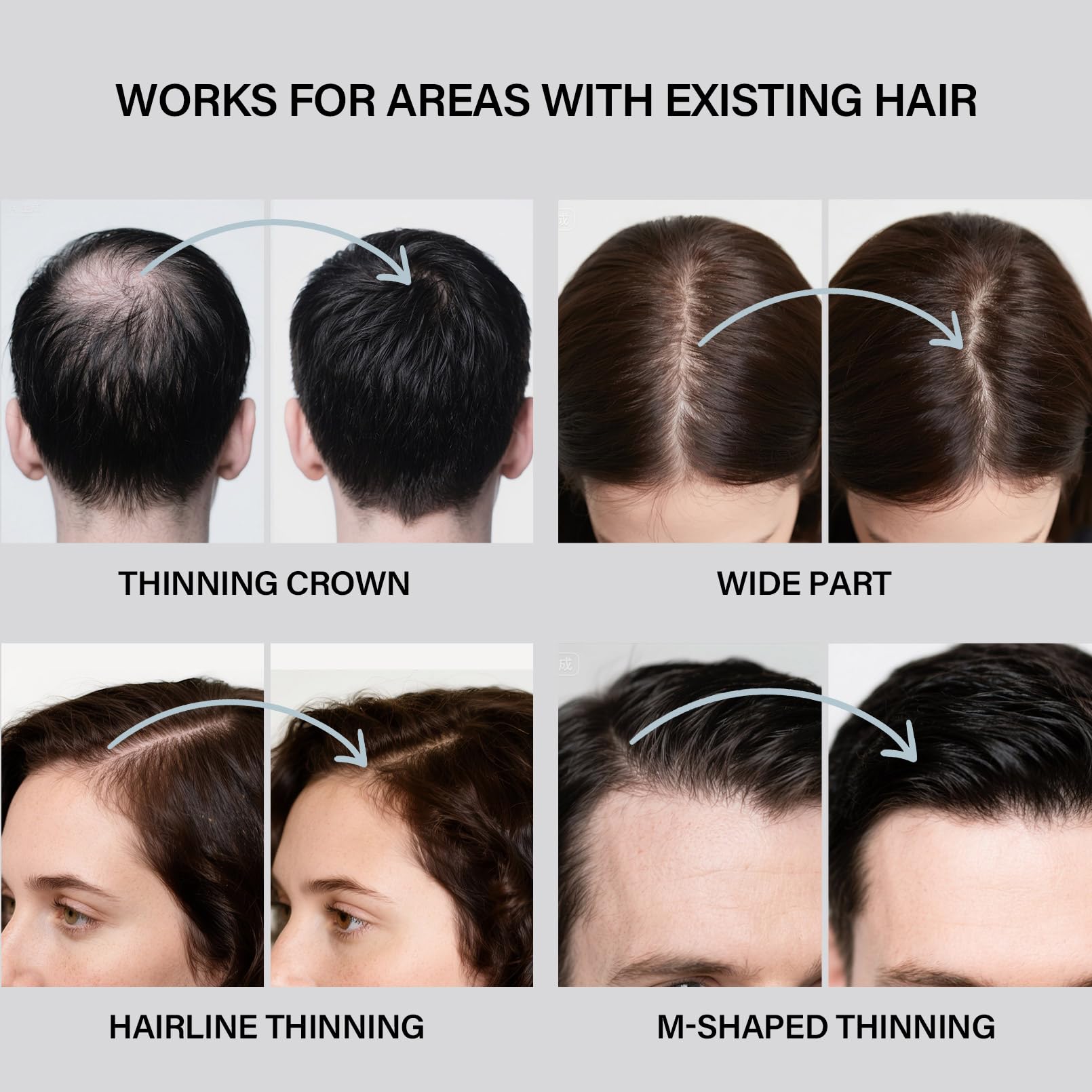 Seaboll natural-coverage-kit shows complete kit for instant thickening.