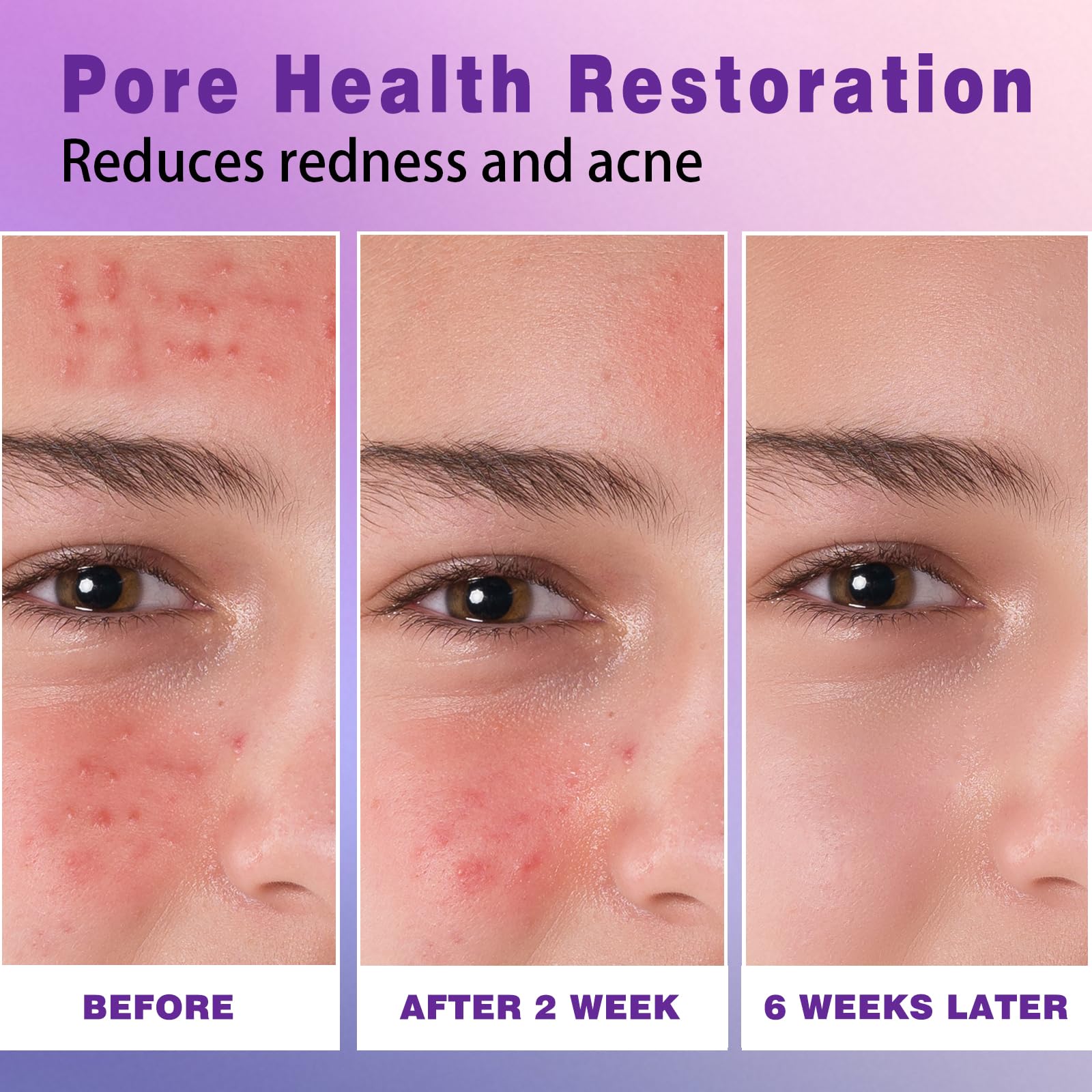 Sefralls azelaic acid cream glow after use for radiant complexion.