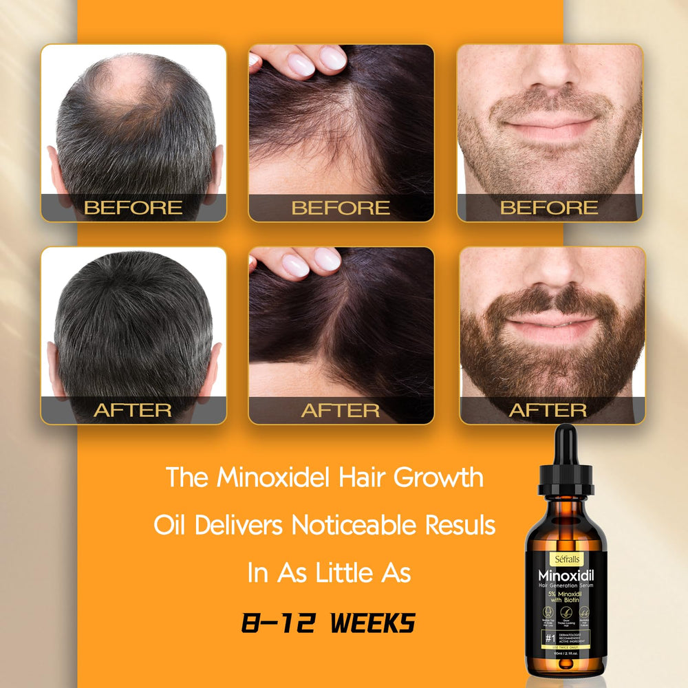 Sefralls Minoxidil hair growth oil on vanity setup signals a fuller hair result.