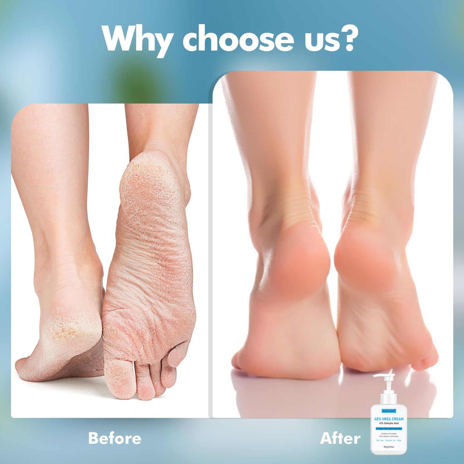 SENKYUNG 40% urea foot cream with coconut oil and aloe for rich moisturizing