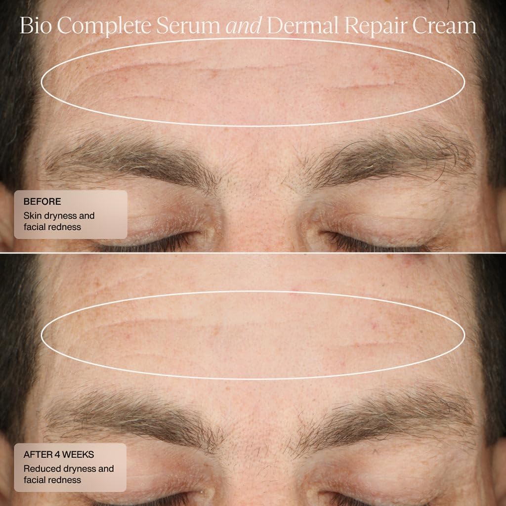 Senté Bio Complete Serum even-tone focus indicates potential for improved skin uniformity.