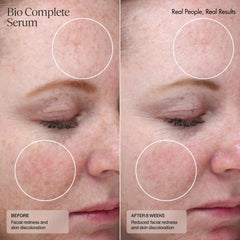 Senté Bio Complete Serum texture close-up highlights a creamy, soothing formula for sensitive skin.