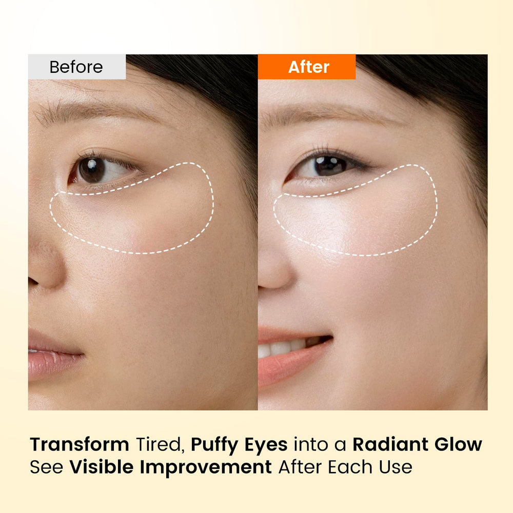SEONGLOW caffeine under-eye patches 30-pairs pack—value for routine use.