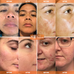 SeoulCeuticals vitamin C application scene suggests daily routine integration.