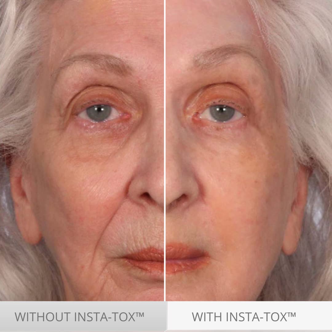 Serious Skincare INSTA-TOX trio bottle close-up emphasizes compact, portable design.