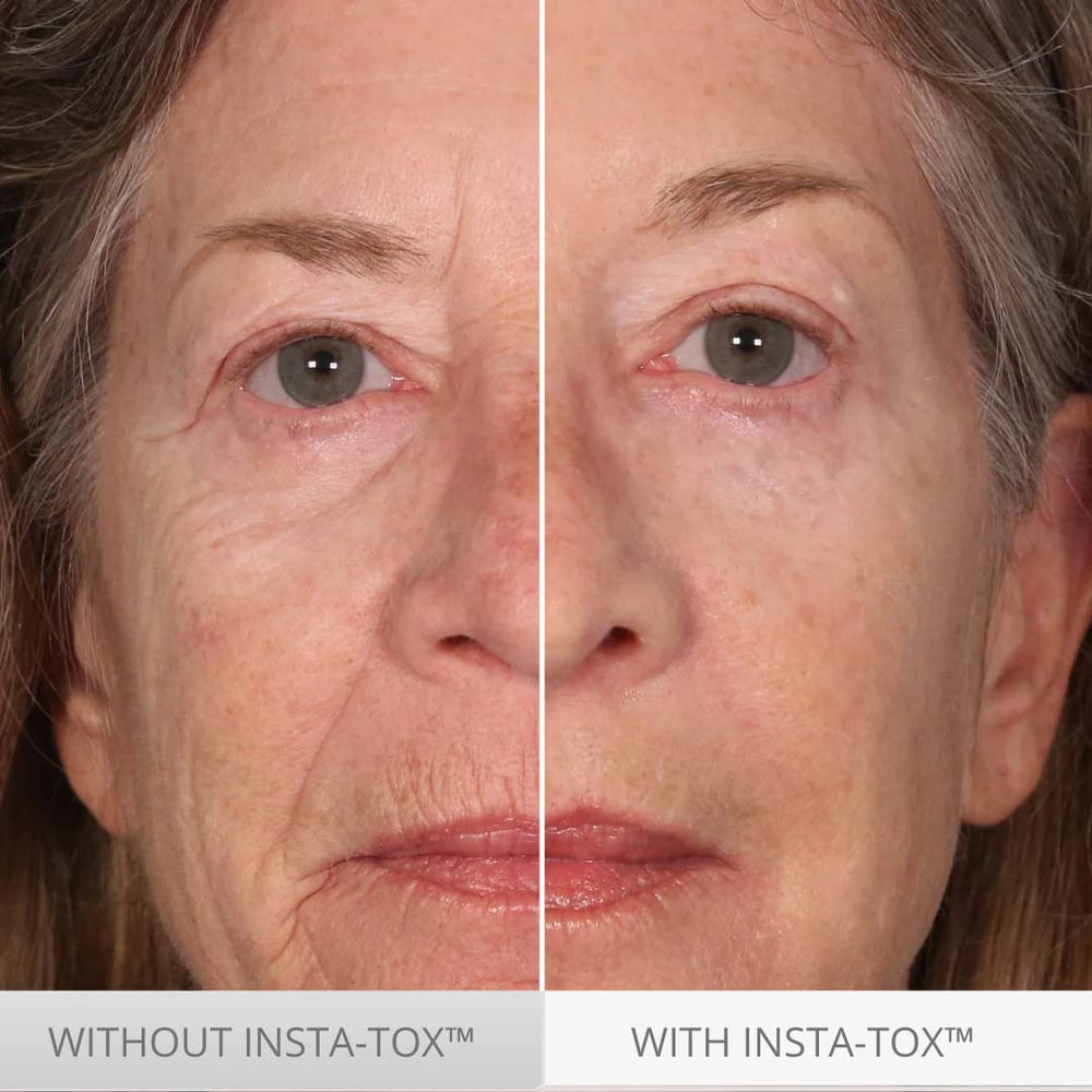 Serious Skincare INSTA-TOX trio delivers quick results in about three minutes.
