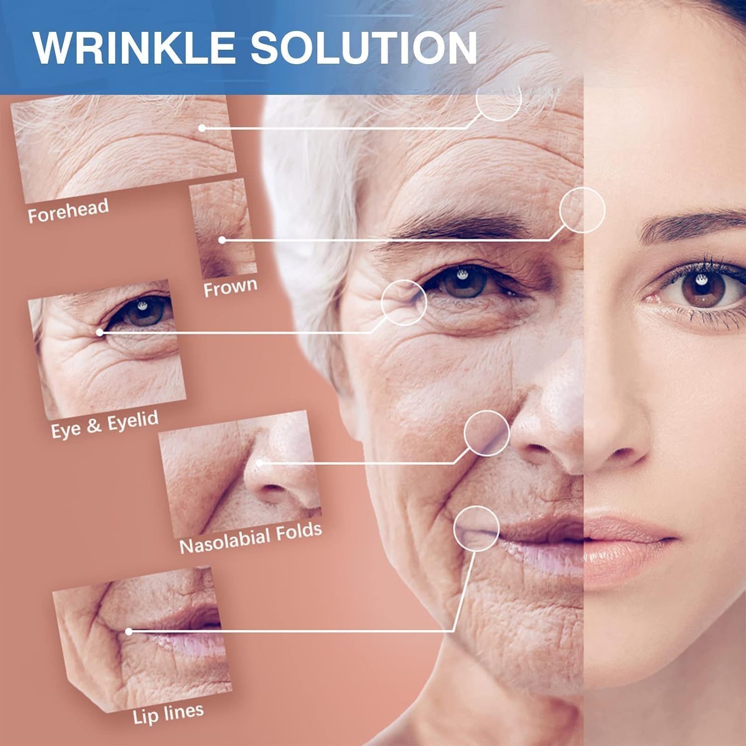Sfuchin face lift usage illustration shows secure adhesion for targeted wrinkle smoothing.