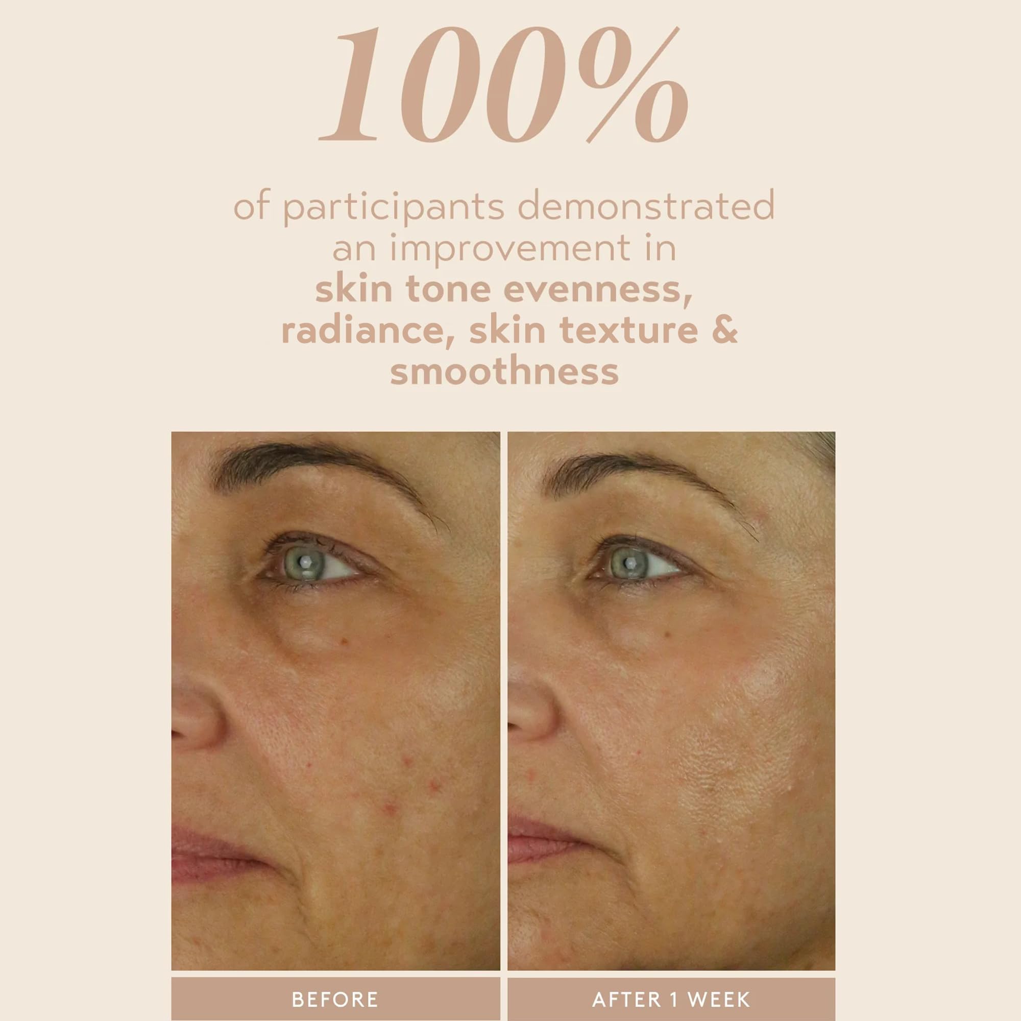 SHANI DARDEN Retinol Reform neck-application demo showing even-toned look.