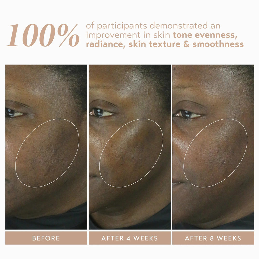 SHANI DARDEN Retinol Reform night routine scene for potential fine-line reduction.