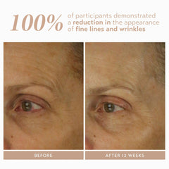 SHANI DARDEN Retinol Reform serum texture close-up for smoother skin texture.