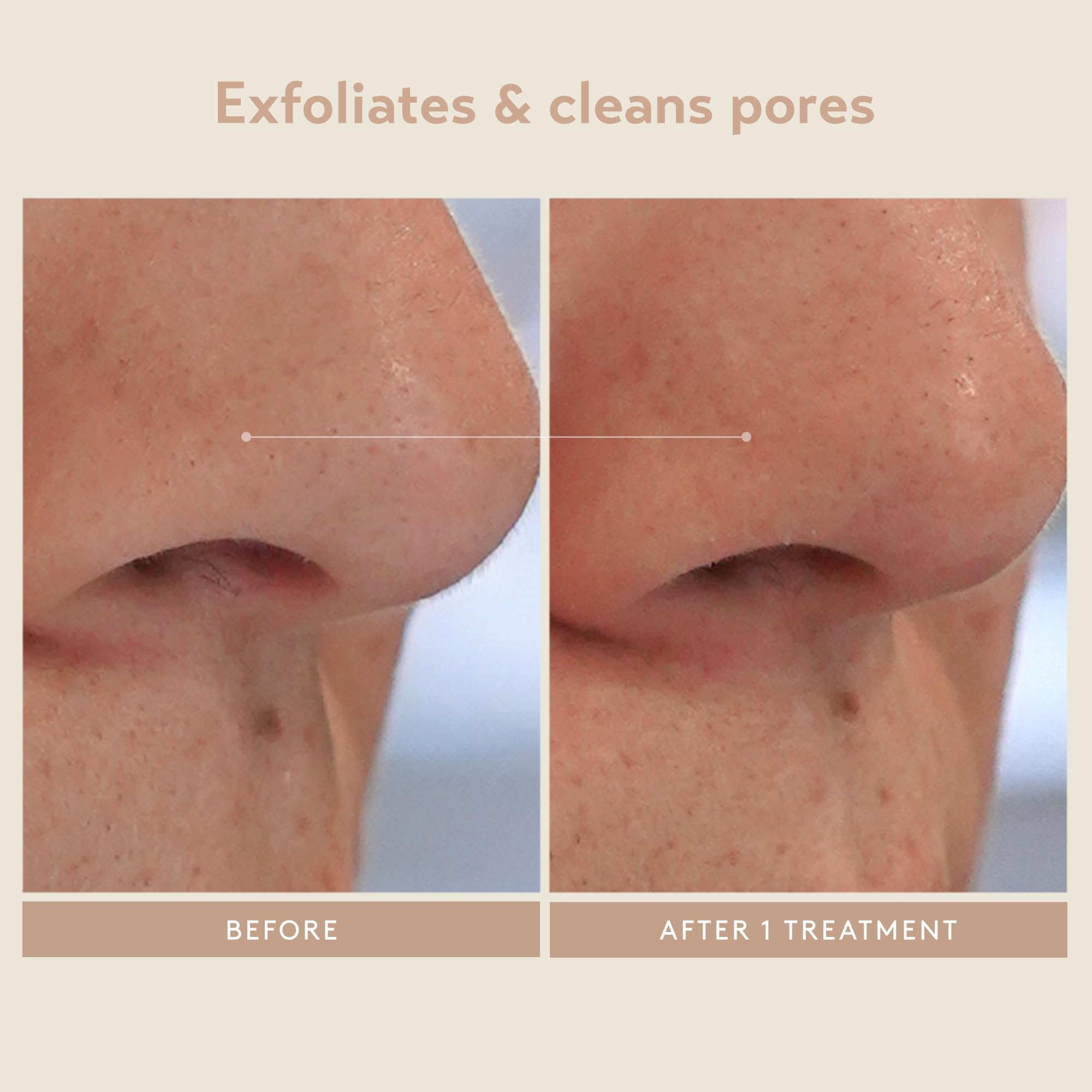 SHANI DARDEN Triple Acid Peel brush-in-use indicates even, controlled application.