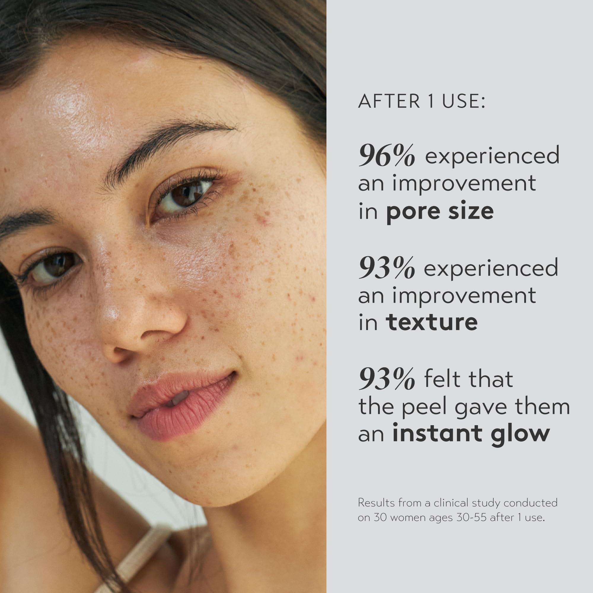 SHANI DARDEN Triple Acid Peel solution-application demonstrates quick exfoliation and smoother texture.