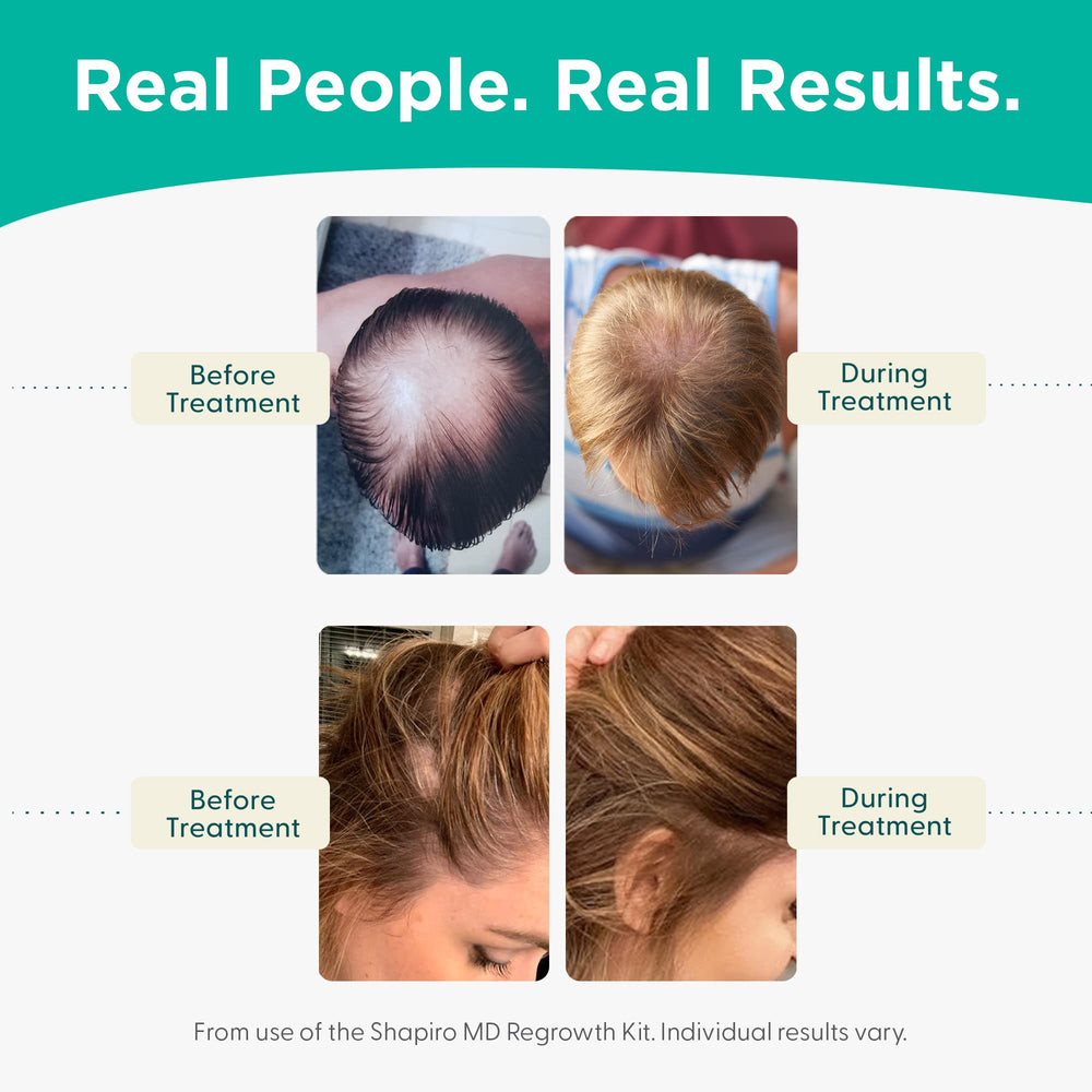Shapiro MD Hair Growth Experts infographic highlights DHT fight and hair-strengthening benefits.