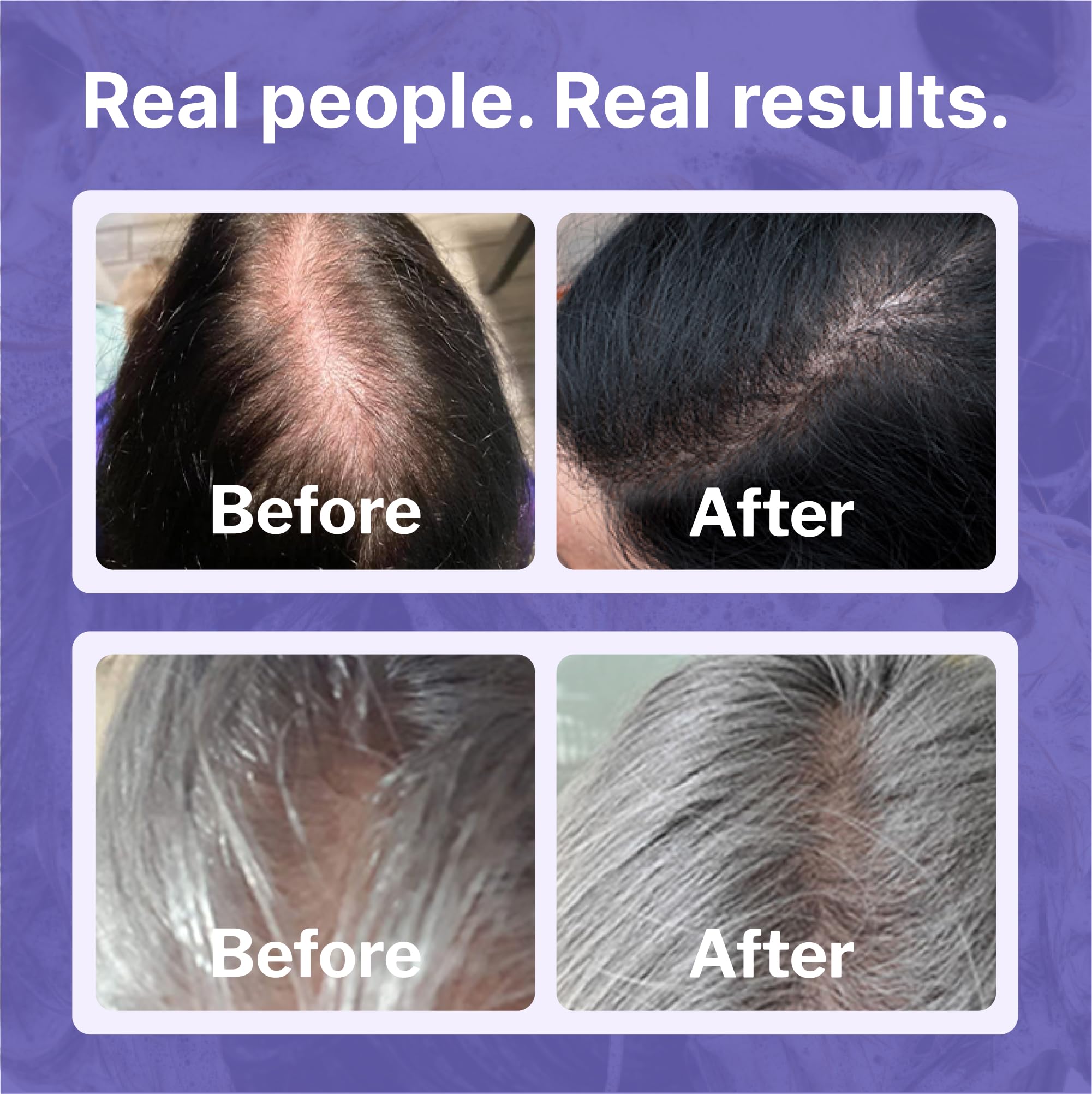 Shapiro MD Minoxidil 2% drying scene showing quick absorption before styling