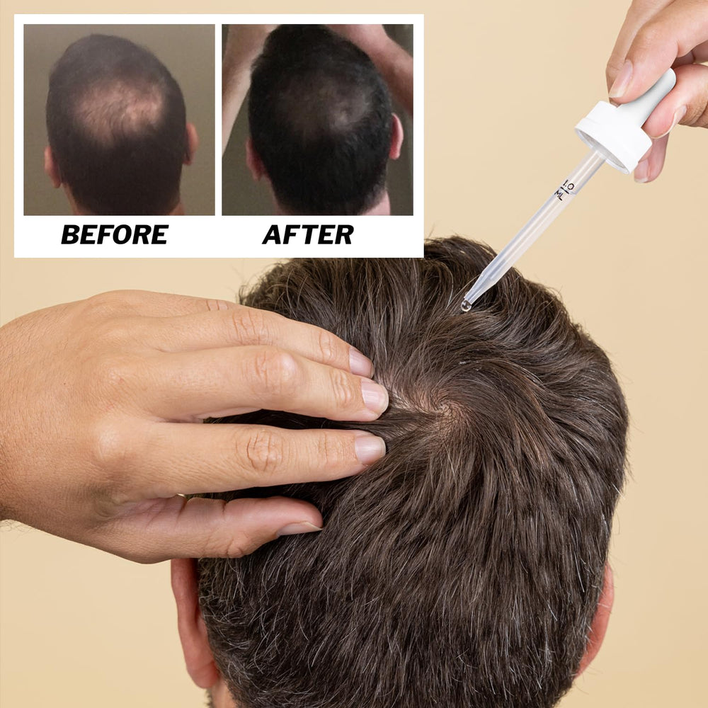 Shapiro MD Regrowth Kit packaging artwork and label for complete solution