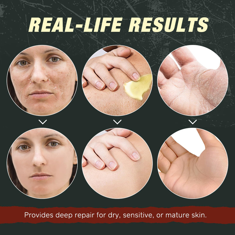Shuangjia frankincense castor oil balm application demonstrating quick absorption.