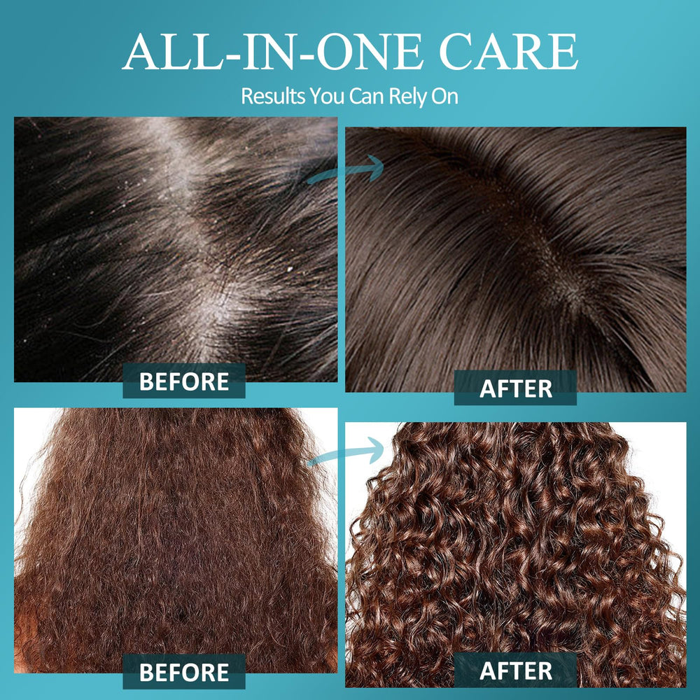 SHVYOG dandruff-control-closeup highlights flake-reducing potential and clean scalp look