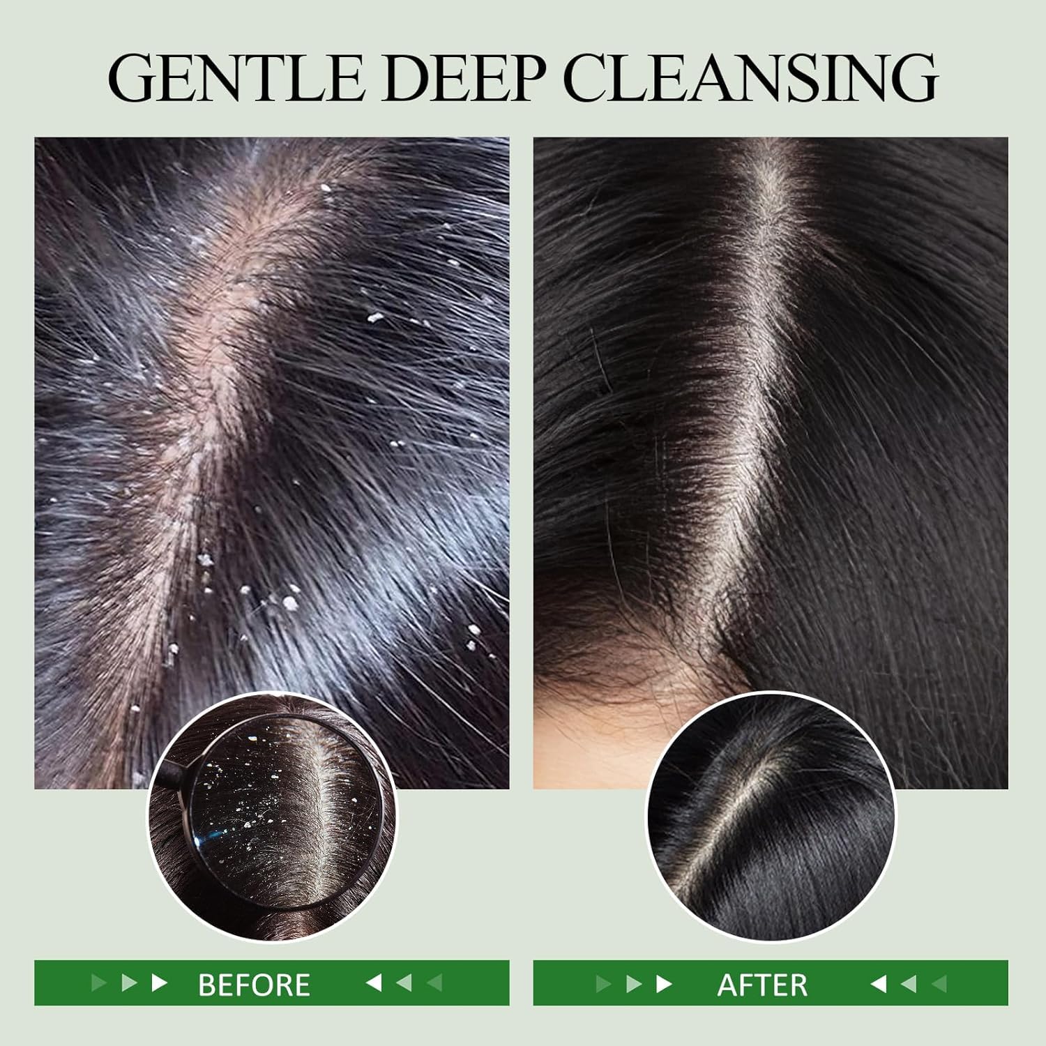 SHVYOG rosemary and peppermint oils detail offers refreshing cooling sensation for the scalp