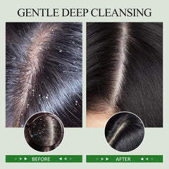 SHVYOG rosemary and peppermint oils detail offers refreshing cooling sensation for the scalp