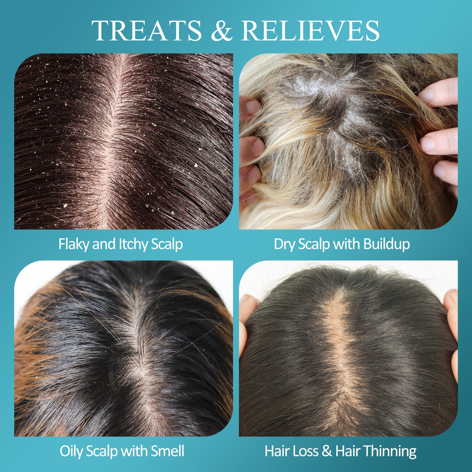 SHVYOG scalp-scrub-application-closeup demonstrates exfoliation and even distribution
