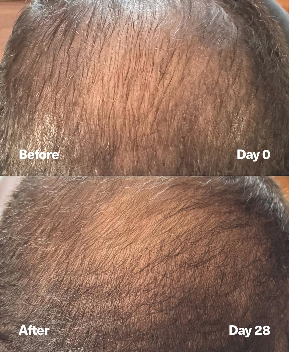 SickScience PowerCycle exosome serum ingredients with caffeine and niacinamide for scalp care