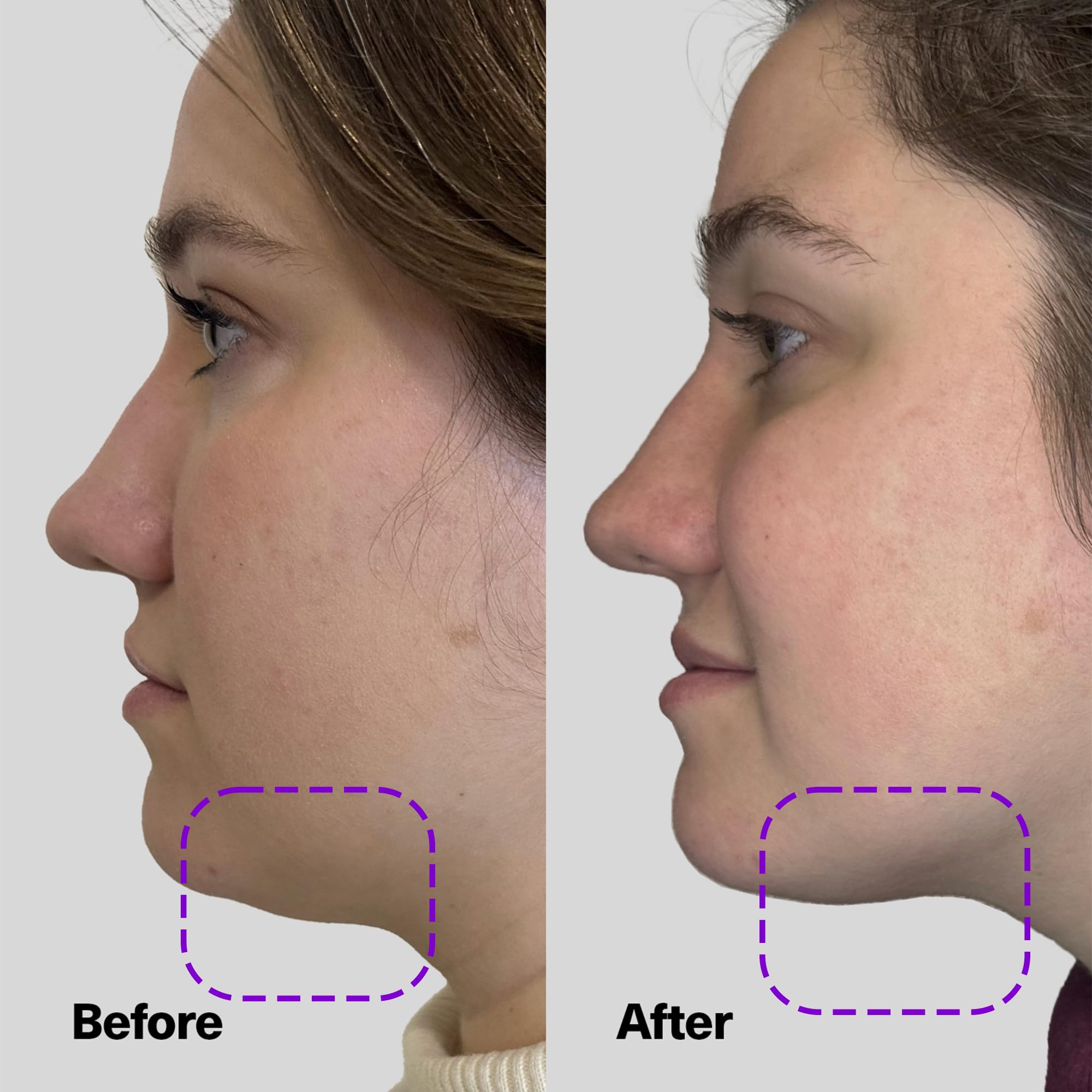 SickScience ShapeShift neck-firming-serum swatch indicates smooth, hydrated neck area
