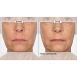 Moisturizers help plump appearance and smooth rough texture.