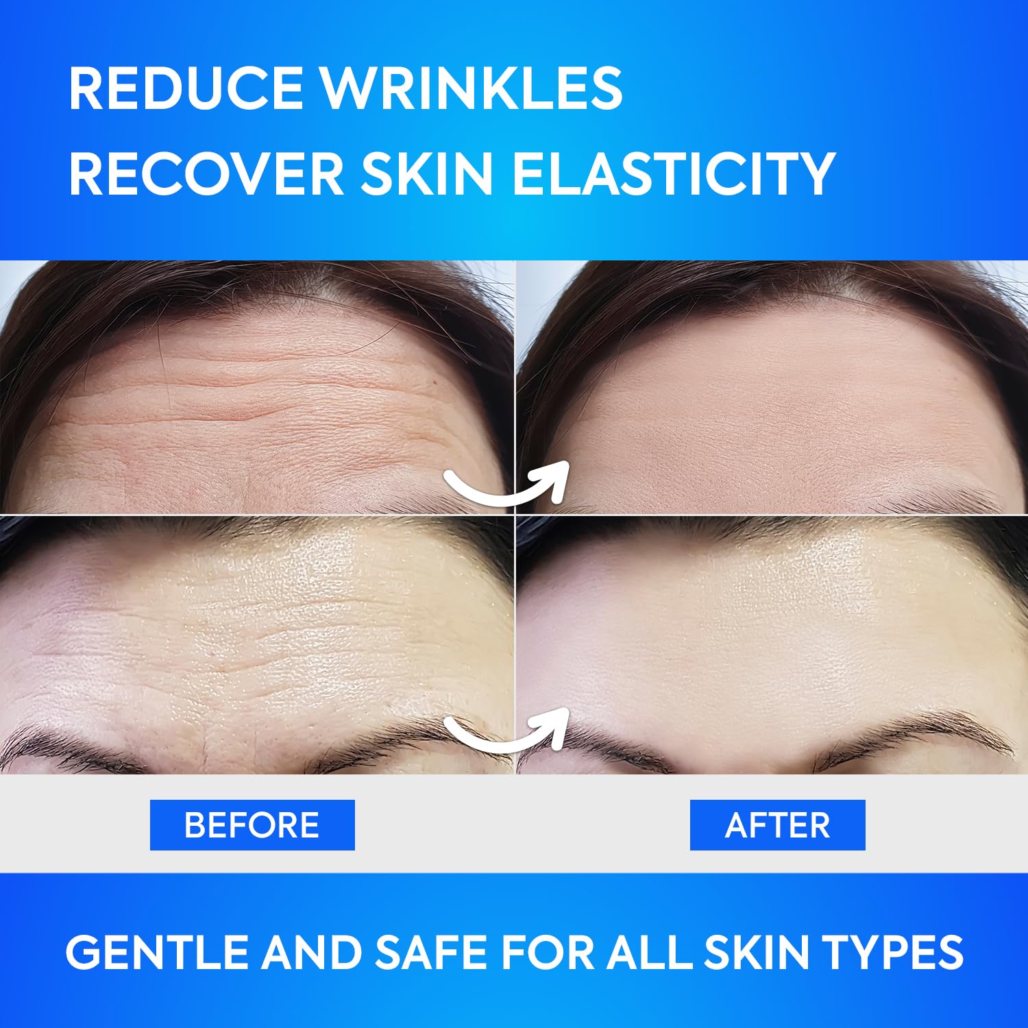 SILKDERMIS firmer-skin-appearance close-up highlights potential smoothing of forehead lines.