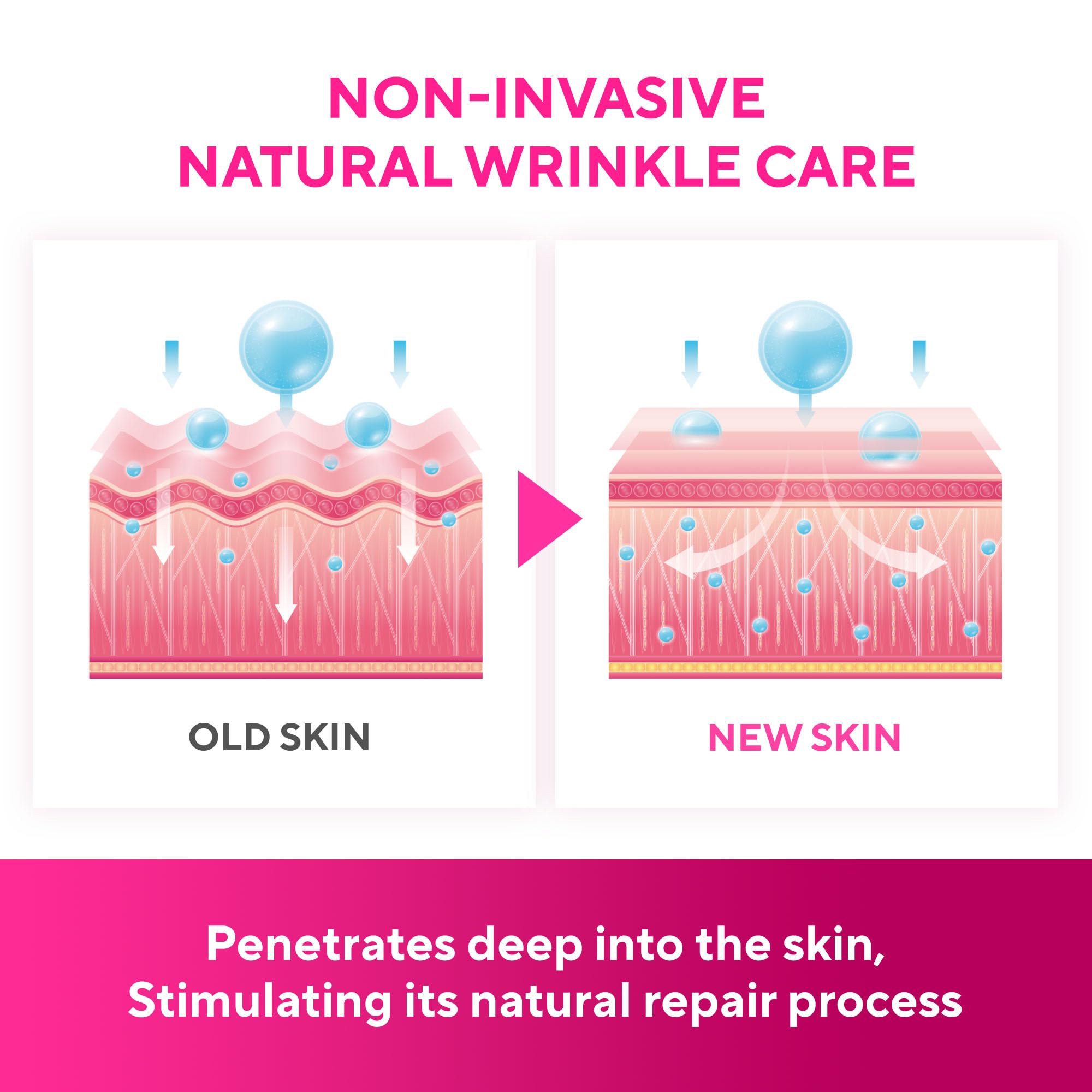 SILKDERMIS silicone face patch suitable for all skin types