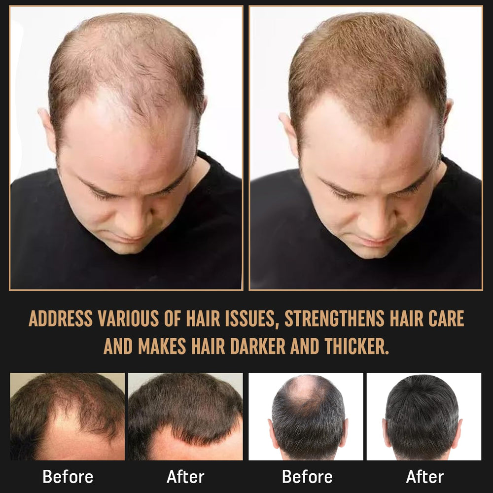 Simnoble all hair types visual—suitable for curly, straight, or damaged hair.