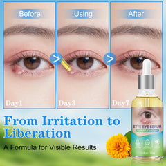 sinBron natural plant extracts ingredients highlight gentle, soothing eye care
