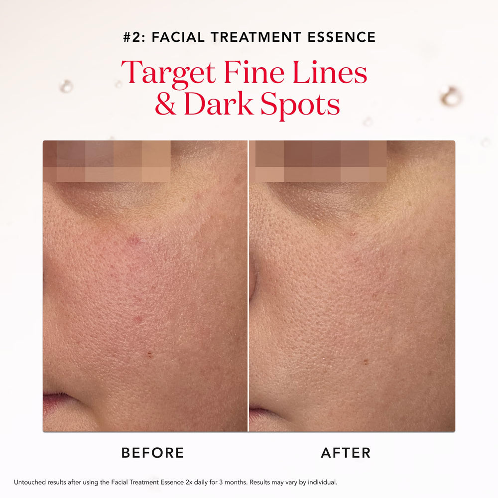 Ultraura Essence Serum bottle brightens skin with Niacinamide and Pitera