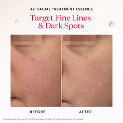 Ultraura Essence Serum bottle brightens skin with Niacinamide and Pitera