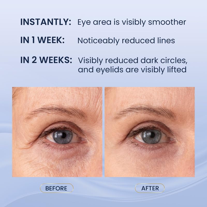 SKIN ULTIMA Dual Eye Cream upper-eye application demonstrates eyelid lifting effect.