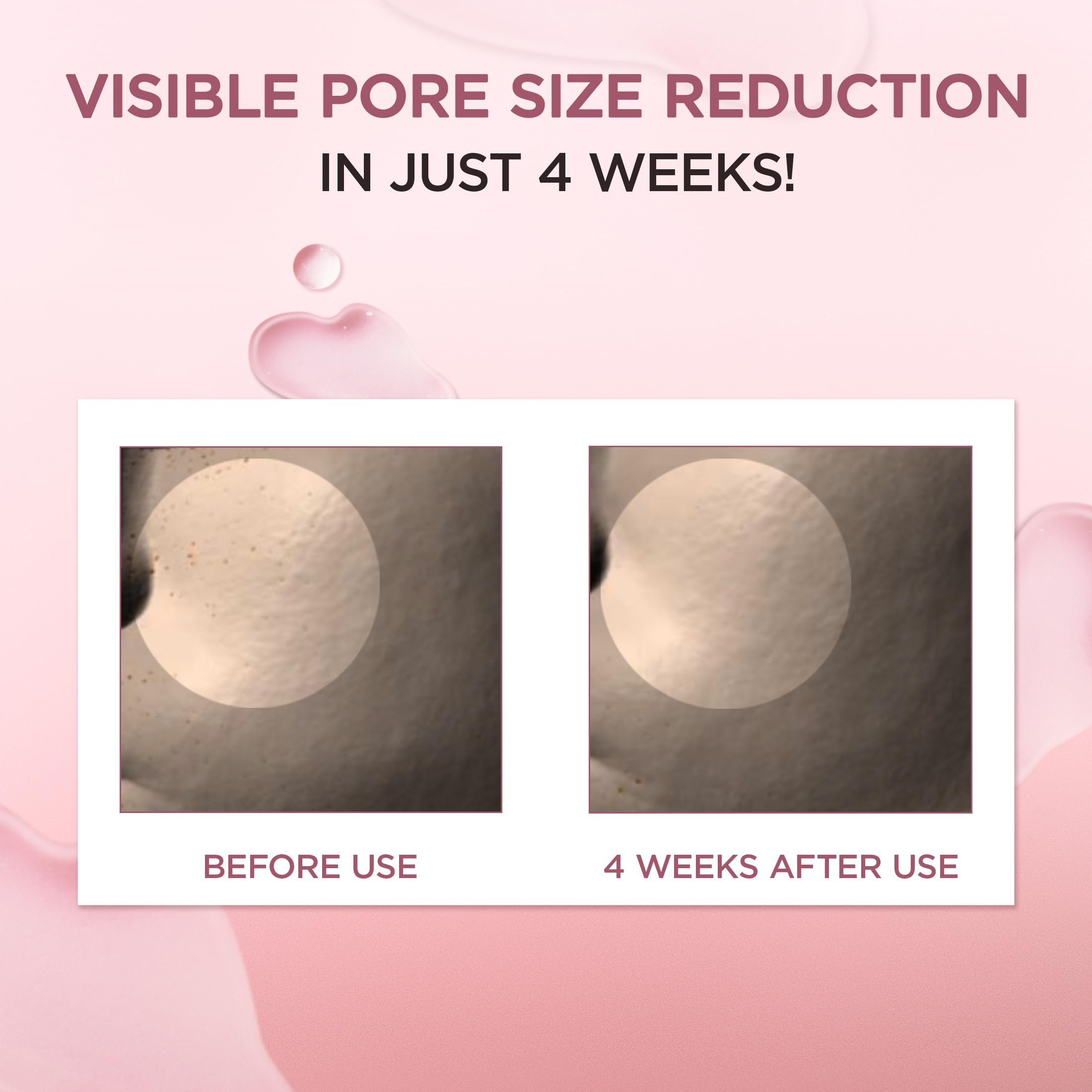 SKIN1004 sebum-control illustration reveals balanced skin shine.