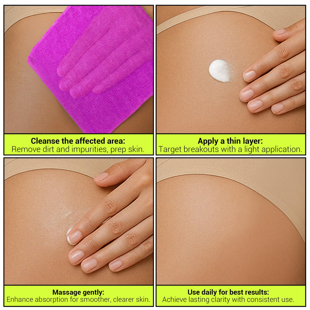 SKINBOSS Anti-Blemish Body Lotion fast-drying formula for daily use.