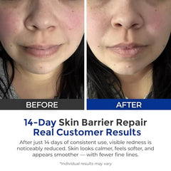 SKINERSE Intensive Repair Serum hyaluronic-acid swirl conveys deep hydration.