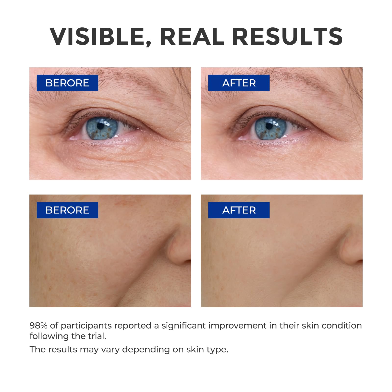 SKINERSE serum texture applied to skin demonstrates lightweight, non-greasy finish.